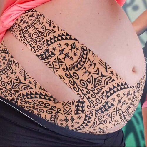 Taping dynamiczny w uroginekologii