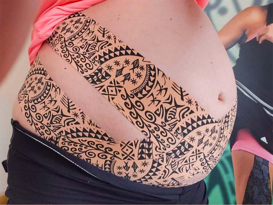 Taping szkolenie uroginekologia